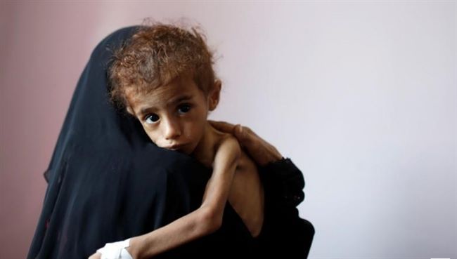 رويترز:الأمم المتحدة تحذر وتعلن عدد ملايين اليمنيين ممن هم على شفا المجاعة 