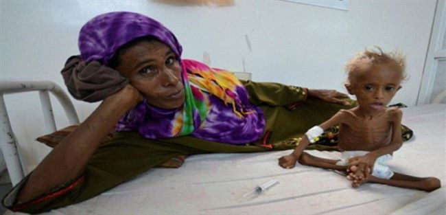قناة بي بي سي:الموت جوعا يهدد 13 مليون يمني خلال الأشهر المقبلة(فيديو)