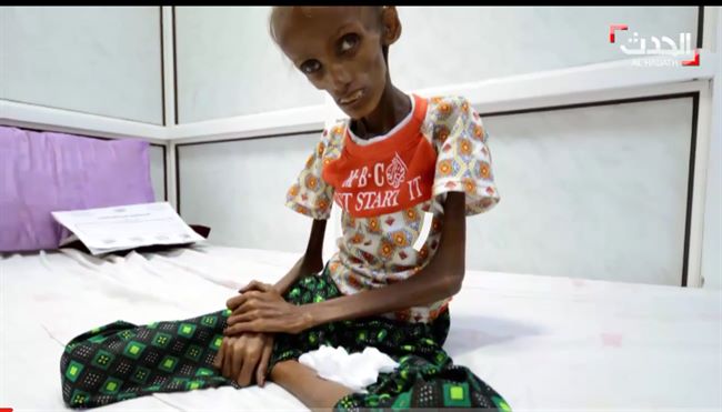 منظمة اغاثة إنسانية تؤكد عدم تحسن الوضع الاقتصادي باليمن وأطفاله يموتون جوعا